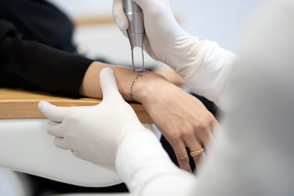 Tattooentfernung-mit-dem-Laser-Ärzte-Clearink-Mannheim-Heidelberg-Karlsruhe